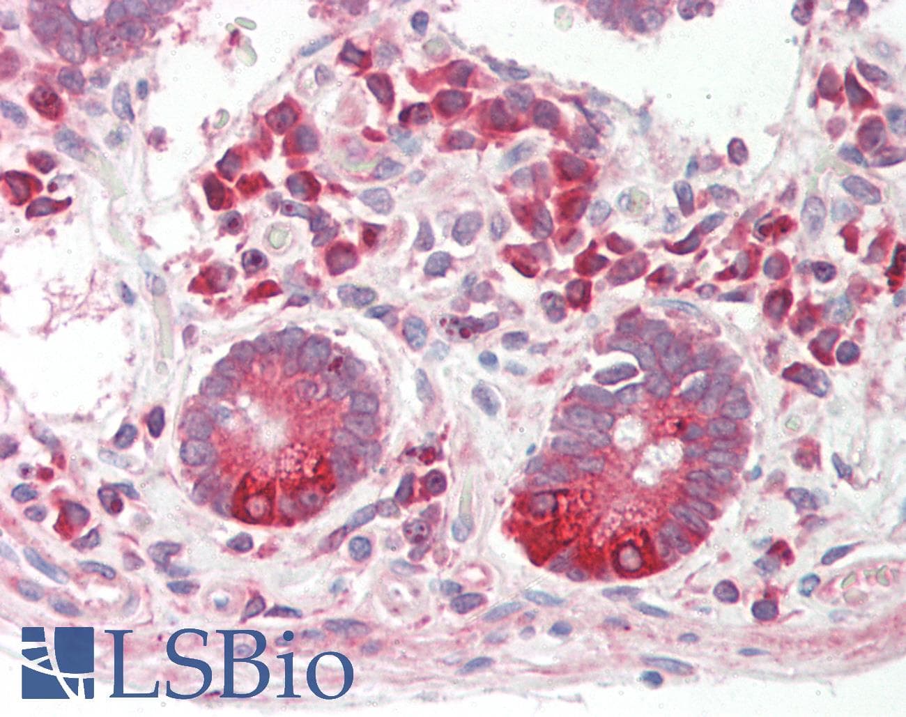 LIN7C / VELI3 Antibody (aa108-157)