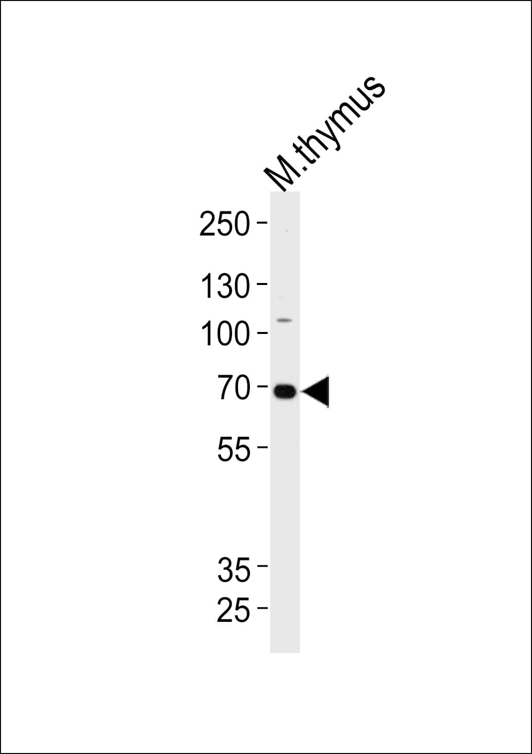Polyclonal Rabbit anti-Mouse EPHB6 / EPH Receptor B6 Antibody (aa503-530, WB)