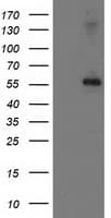 Monoclonal Mouse anti-Human PPM1B Antibody (clone OTI2D9, WB)