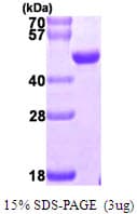 Human NUDT9 Protein (Recombinant His)