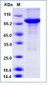 Human KEAP1 Protein (Recombinant His-GST, N-terminus)