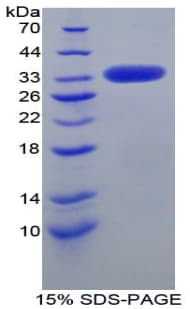 Mouse LRP1 / CD91 Protein (Recombinant His, N-Terminal)