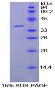 Goat LF / LTF / Lactoferrin Protein (Recombinant His)