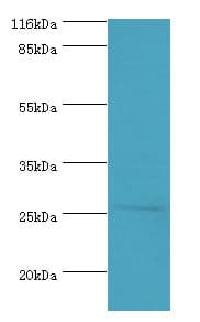 HOXA6 Antibody (Biotin)