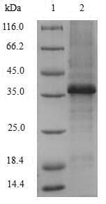 Human VCAN / Versican Protein (Recombinant 10His-B2M, N-terminus + Myc, C-terminus)