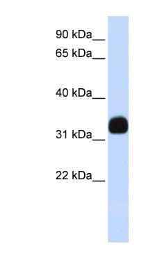 MED27 / CRSP8 Antibody (aa180-229)