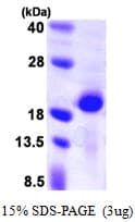 Human PPP3R2 Protein (Recombinant His)