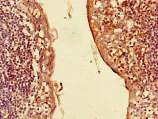 CXCL3 / GRO Gamma Antibody