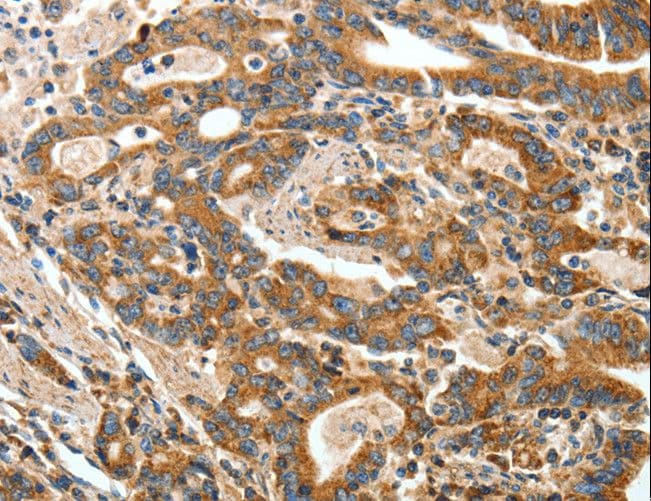 Polyclonal Rabbit anti-Human ANGPTL1 Antibody (IHC)