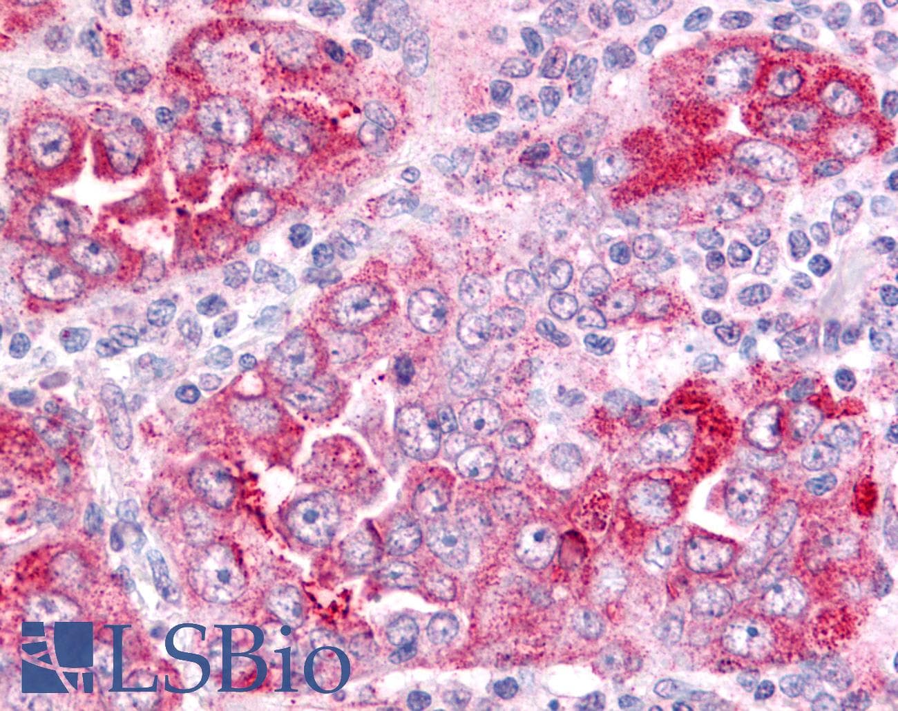 PathPlus™ Polyclonal Rabbit anti-Human PGES / PTGES Antibody (Cytoplasmic Domain, IHC)