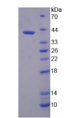 Human SKP2 Protein (Recombinant His-T7)