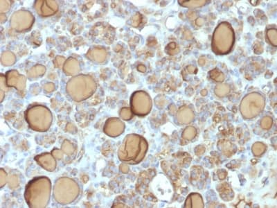 TG / Thyroglobulin Antibody (clone TGB/1970R, Azide-free, Carrier-free)