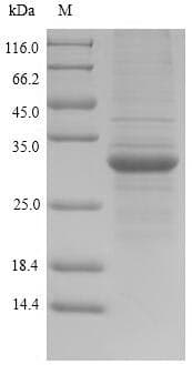 Human HLA-DRA Protein (Recombinant 6His, N-terminus)