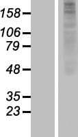 OR1J2 Protein (Over-Expression Lysate Myc-DDK (Flag))