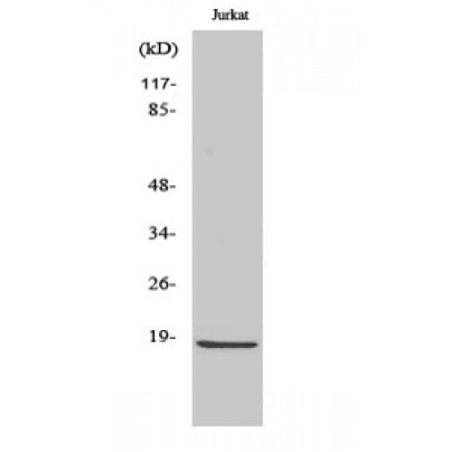 CASP2 / Caspase 2 Antibody (120-200 aa, Internal)
