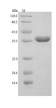 Human LGALS9 / Galectin 9 Protein (Recombinant 6His, N-terminus)