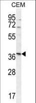 Polyclonal Rabbit anti-Human NXPH4 Antibody (aa219-248, WB)