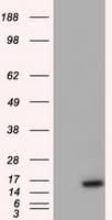 BIRC5 / Survivin Antibody (clone OTI2D9)
