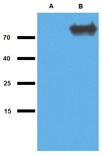 Mycobacterium tuberculosis GlcB Antibody (clone Polyclonal)