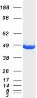 Human CKM / Creatine Kinase MM Protein (Recombinant Myc-DDK (Flag))