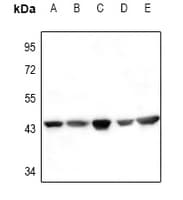 Polyclonal Rabbit anti-Human ACTA2 / Smooth Muscle Actin Antibody (WB)