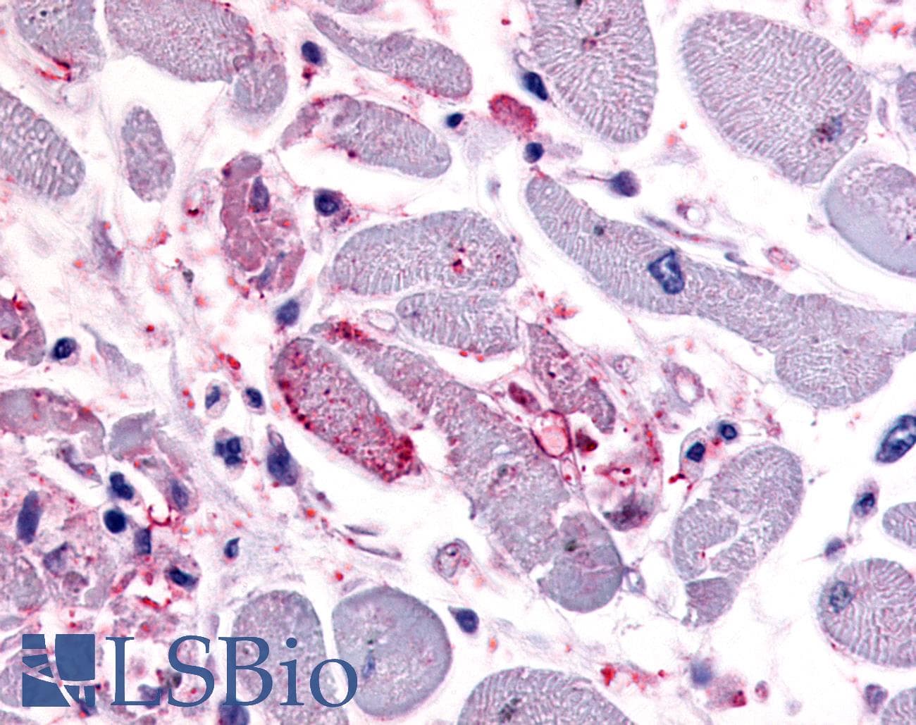 IHC-plus™ CXCR4 Antibody (C-Terminus)