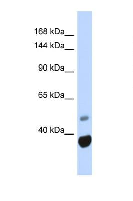 ANKRD12 Antibody (aa21-70)