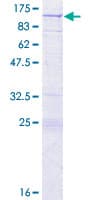 Human CCM1 / KRIT1 Protein (Recombinant GST)