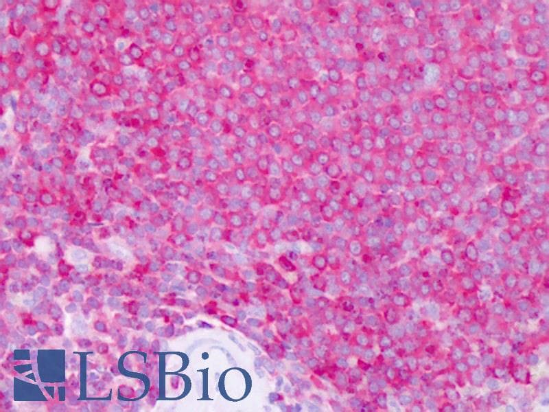 IHC-plus™ EZR / Ezrin Antibody (aa479-498)