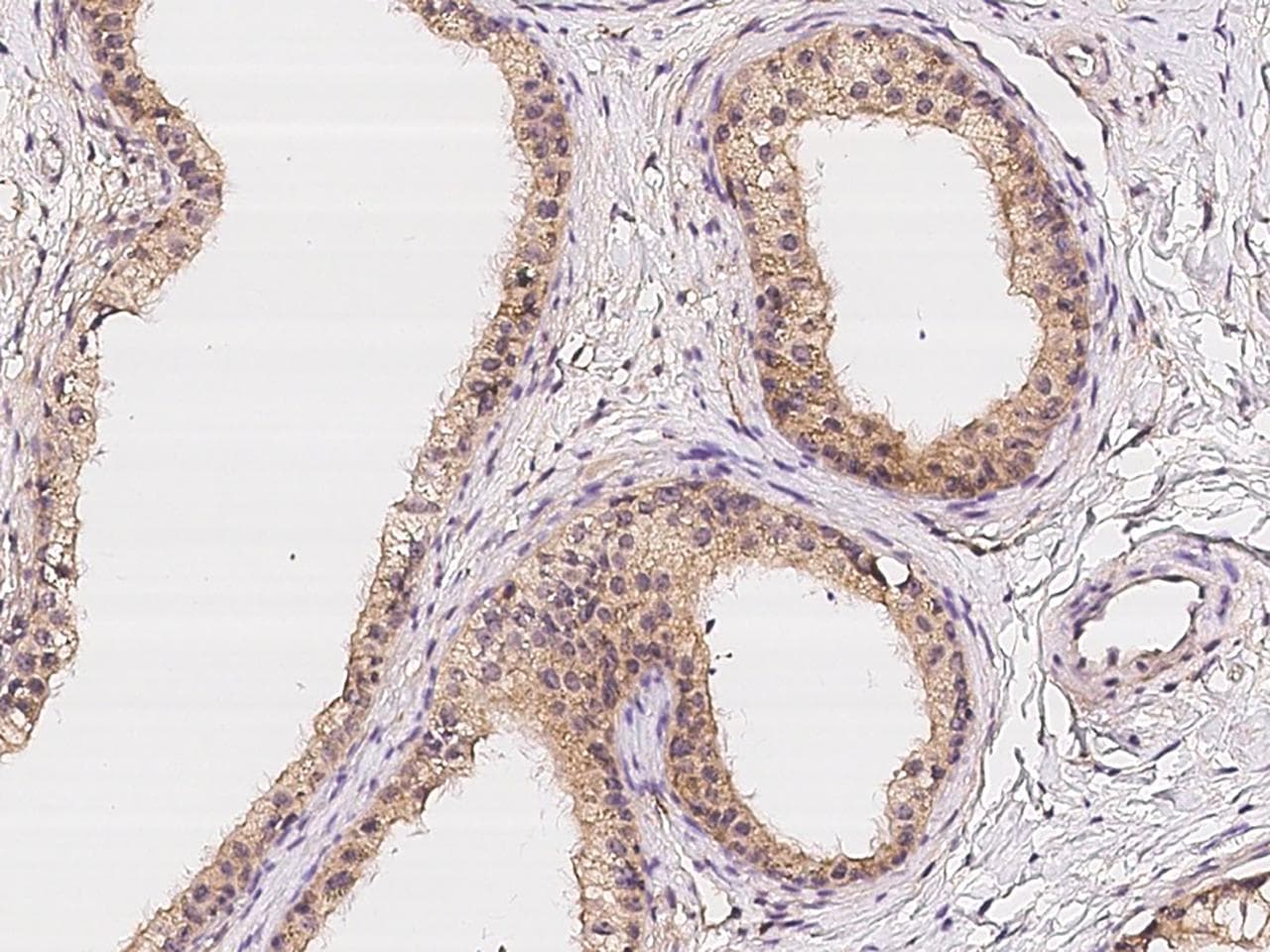 LPCAT2 Antibody
