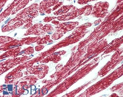 PathPlus™ Polyclonal Rabbit anti-Human ROR1 Antibody (IHC)