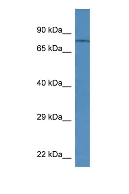 TRPV6 Antibody (aa280-329)