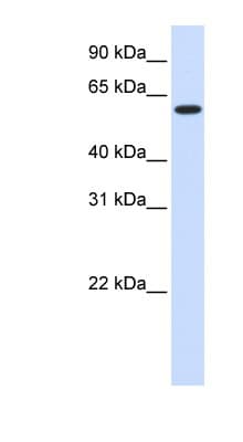UGT8 Antibody (aa396-445)