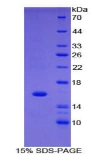 Human FABP1 / L-FABP Protein (Recombinant His)