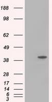 ACAT2 Antibody (clone OTI1B7)