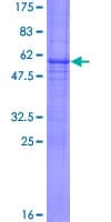 Human TNFRSF9 / 4-1BB / CD137 Protein (Recombinant GST)