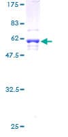 Human RPL34 / Ribosomal Protein L34 (Recombinant GST)