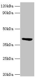 ST3GAL3 / ST3N Antibody