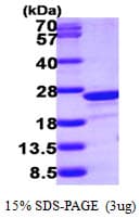 Human TAGLN2 / Transgelin 2 Protein (Recombinant His)