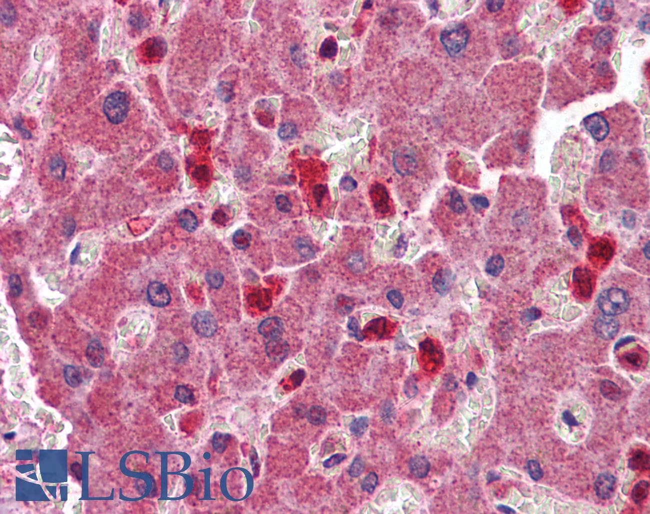 IHC-plus™ PYCARD / ASC / TMS1 Antibody (aa182-195)