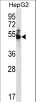 DPH7 / WDR85 Antibody (aa23-51)