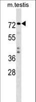 TRIM41 Antibody (aa567-596)