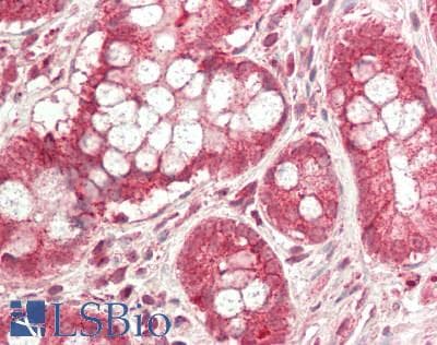 IHC-plus™ Polyclonal Rabbit anti-Human CD47 Antibody (IHC, IF, WB)