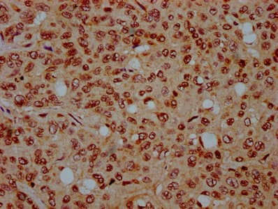 Polyclonal Rabbit anti-Human HIST1H4I Antibody (IHC)