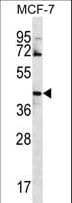 GNA14 Antibody (aa4-33)