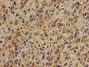 PLCB1 / Phospholipase C Beta 1 Antibody