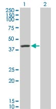 SERPINA6 / CBG Antibody (clone 1F11)
