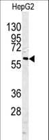 CASP10 / Caspase 10 Antibody (aa164-192)