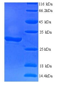Human CELA2A / ELA2A Protein (Recombinant 6His, N-terminus)