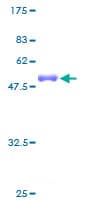 Human CDKN1B / p27 Kip1 Protein (Recombinant GST)